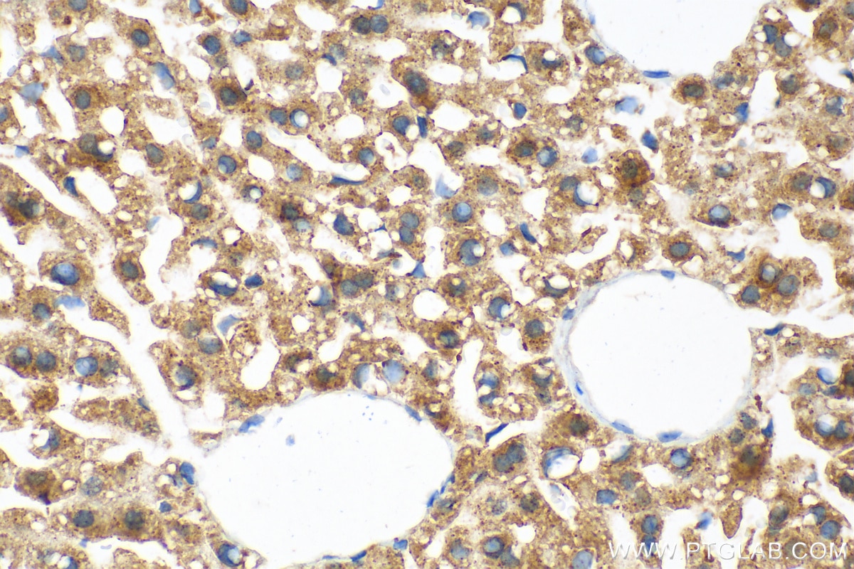 Immunohistochemistry (IHC) staining of mouse liver tissue using CARNS1 Polyclonal antibody (25725-1-AP)