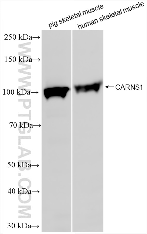 Western Blot (WB) analysis of various lysates using CARNS1 Recombinant monoclonal antibody (88342-1-RR)