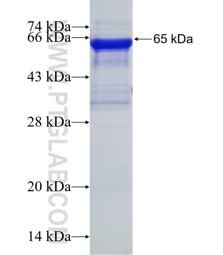 ATPGD1 fusion protein Ag22761 SDS-PAGE ATPGD1 fusion protein Ag22761 SDS-PAGE