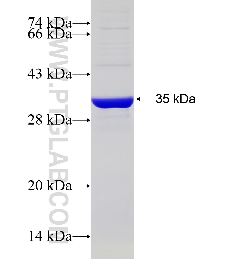 ATPGD1 fusion protein Ag32724 SDS-PAGE ATPGD1 fusion protein Ag32724 SDS-PAGE