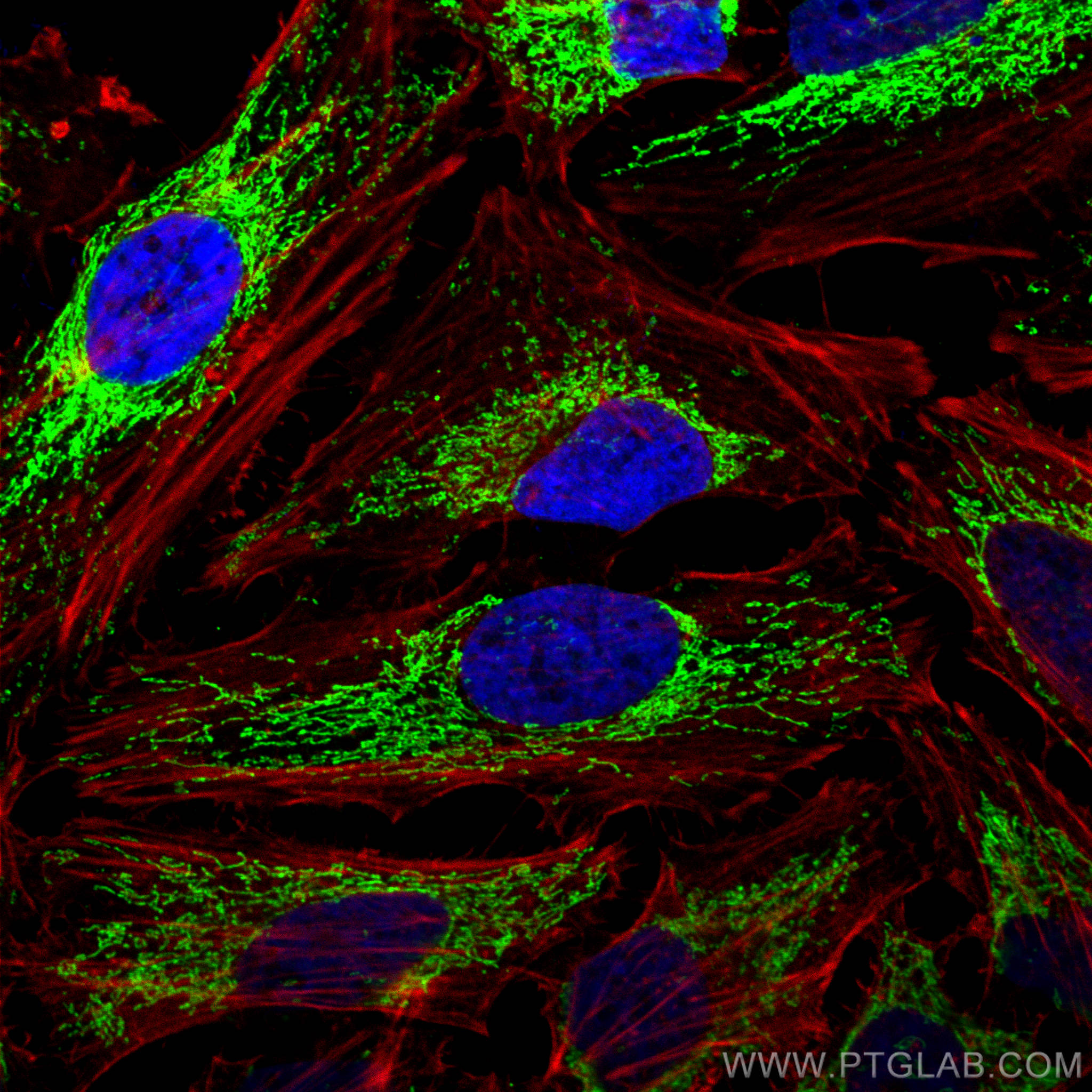 Immunofluorescent analysis of (4% PFA) fixed HeLa cells using ATPIF1 antibody (12067-1-AP) at dilution of 1:200 and CoraLite®488-Conjugated AffiniPure Goat Anti-Rabbit IgG(H+L), CL594-Phalloidin (red). Immunofluorescence (IF) / fluorescent staining of HeLa cells using ATPIF1 Polyclonal antibody (12067-1-AP)