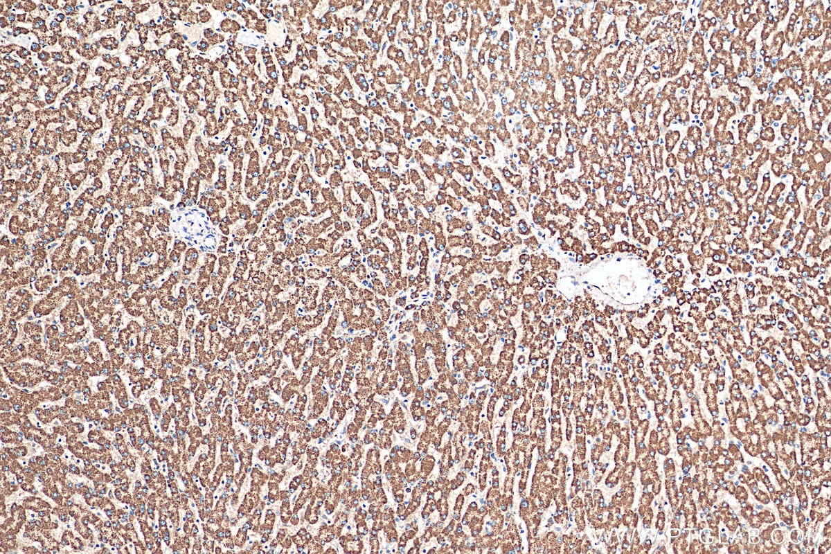 Immunohistochemistry (IHC) staining of human liver tissue using ATPIF1 Polyclonal antibody (12067-1-AP)