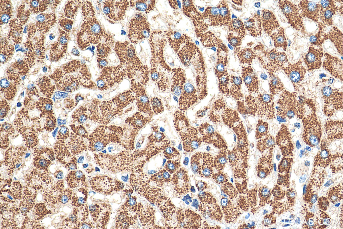Immunohistochemistry (IHC) staining of human liver tissue using ATPIF1 Polyclonal antibody (12067-1-AP)