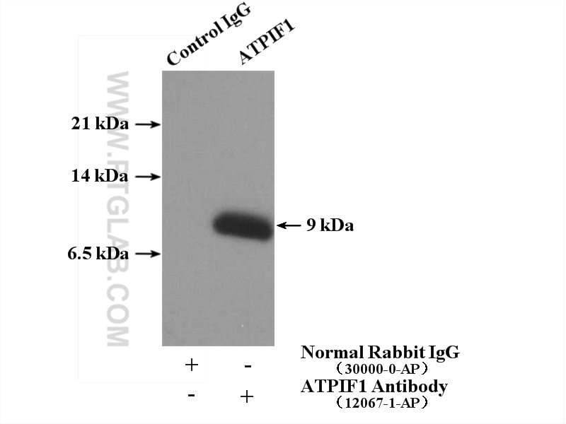 Immunoprecipitation (IP) experiment of HeLa cells using ATPIF1 Polyclonal antibody (12067-1-AP)