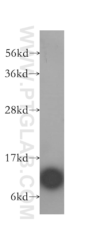 WB analysis of HeLa using 12067-1-AP