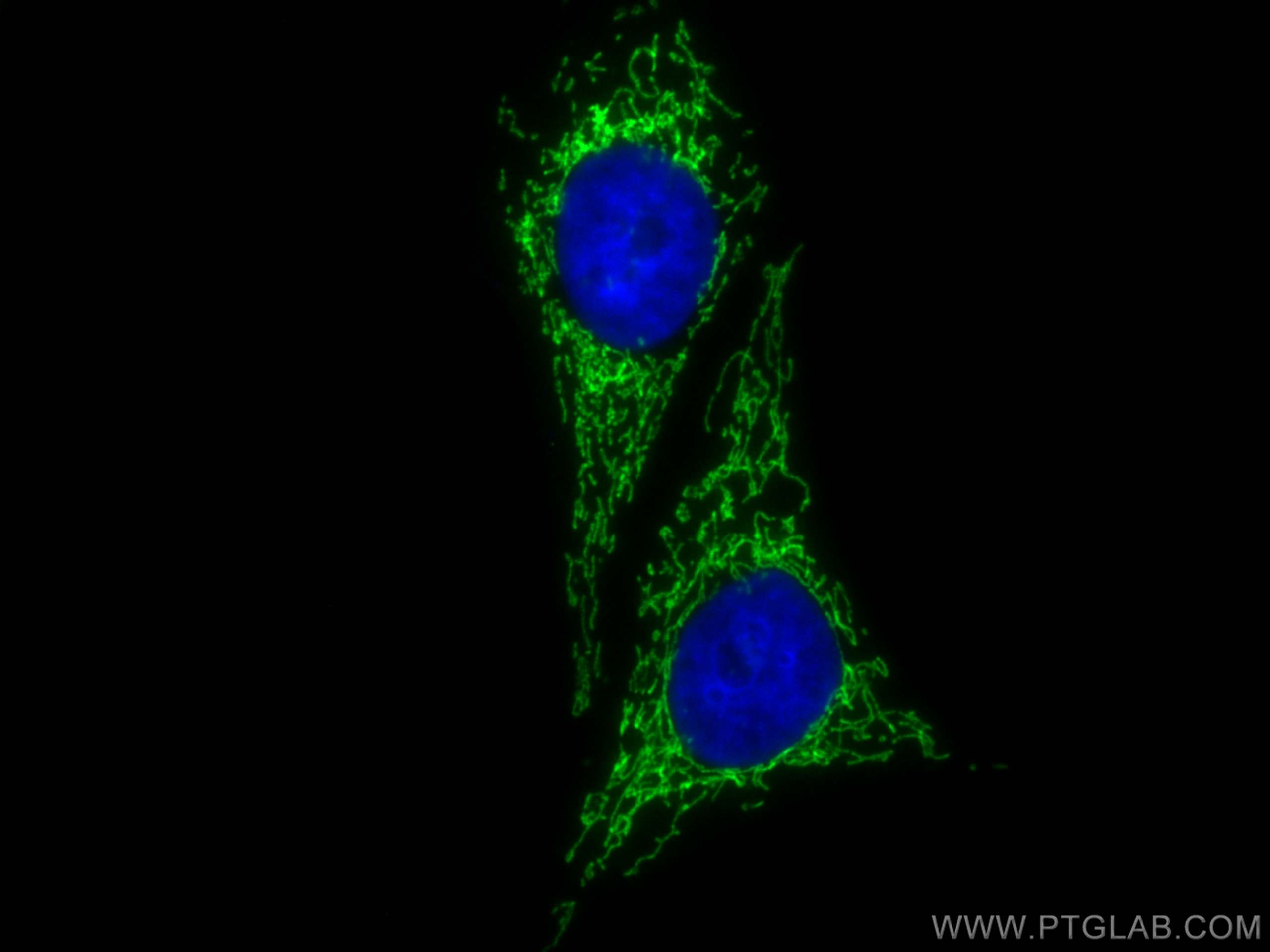 Immunofluorescence (IF) / fluorescent staining of HepG2 cells using CoraLite® Plus 488-conjugated ATPIF1 Polyclonal an (CL488-12067)