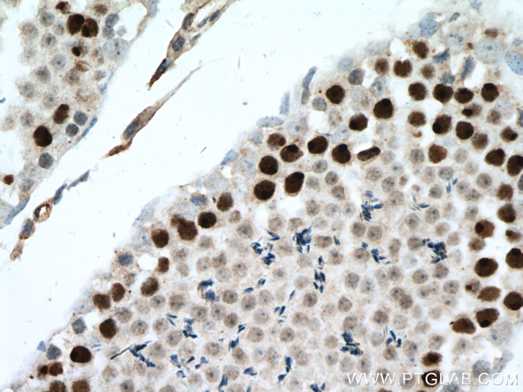 IHC staining of mouse testis using 19787-1-AP