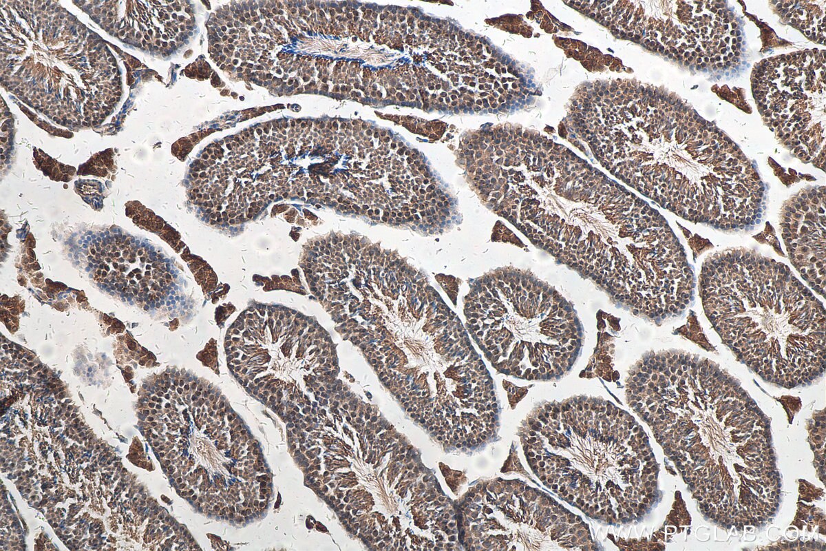 IHC staining of mouse testis using 19787-1-AP