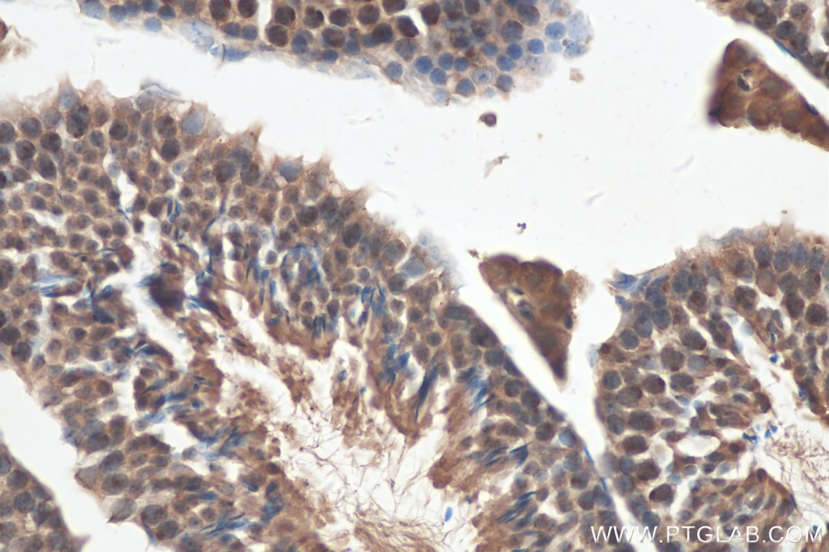 Immunohistochemistry (IHC) staining of mouse testis tissue using ATR Polyclonal antibody (19787-1-AP)