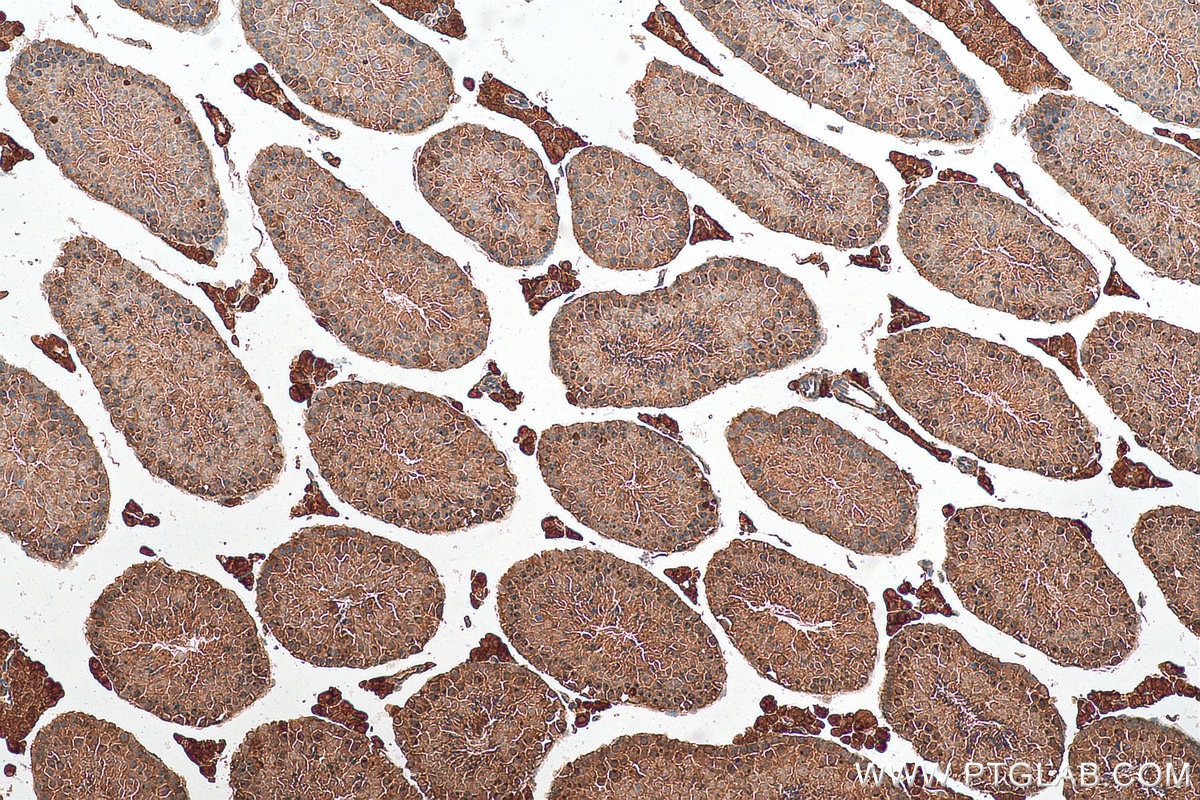 Immunohistochemistry (IHC) staining of mouse testis tissue using ATR Polyclonal antibody (19787-1-AP)