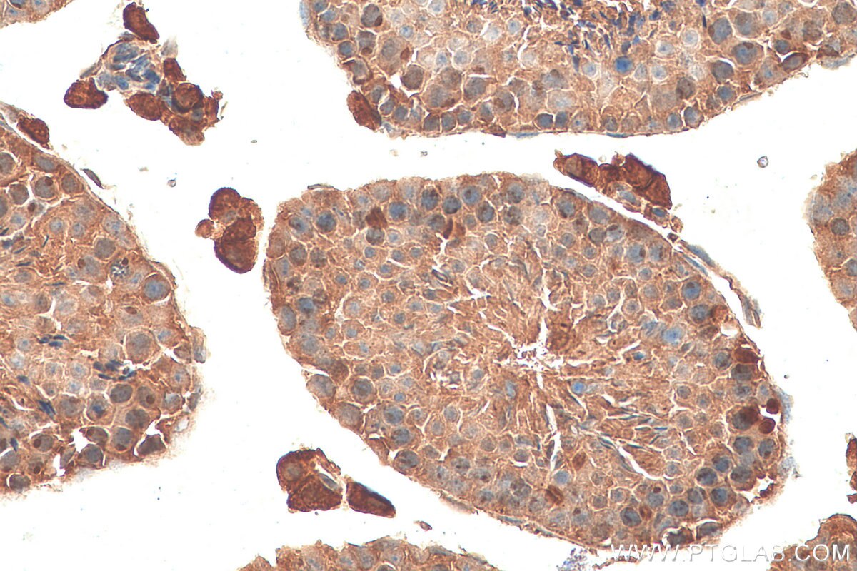Immunohistochemistry (IHC) staining of mouse testis tissue using ATR Polyclonal antibody (19787-1-AP)