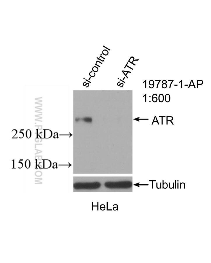 Western Blot (WB) analysis of HeLa cells using ATR Polyclonal antibody (19787-1-AP)