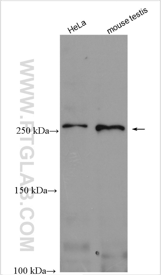 Western Blot (WB) analysis of various lysates using ATR Polyclonal antibody (19787-1-AP)