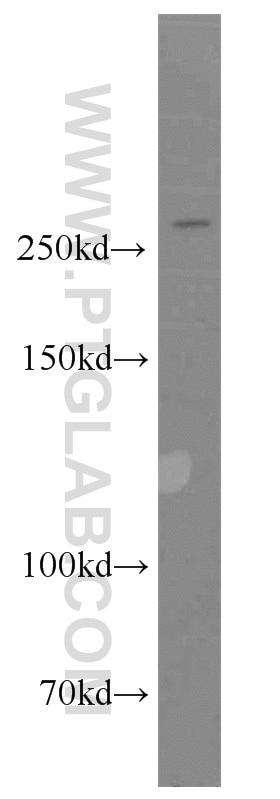 ATR Polyclonal antibody