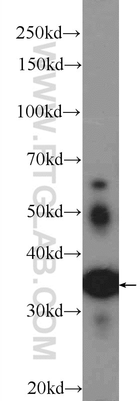 Western Blot (WB) analysis of HEK-293 cells using ATRAID Polyclonal antibody (25548-1-AP)