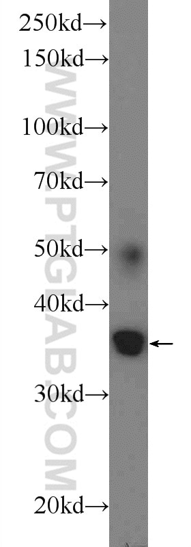 Western Blot (WB) analysis of mouse brain tissue using ATRAID Polyclonal antibody (25548-1-AP)