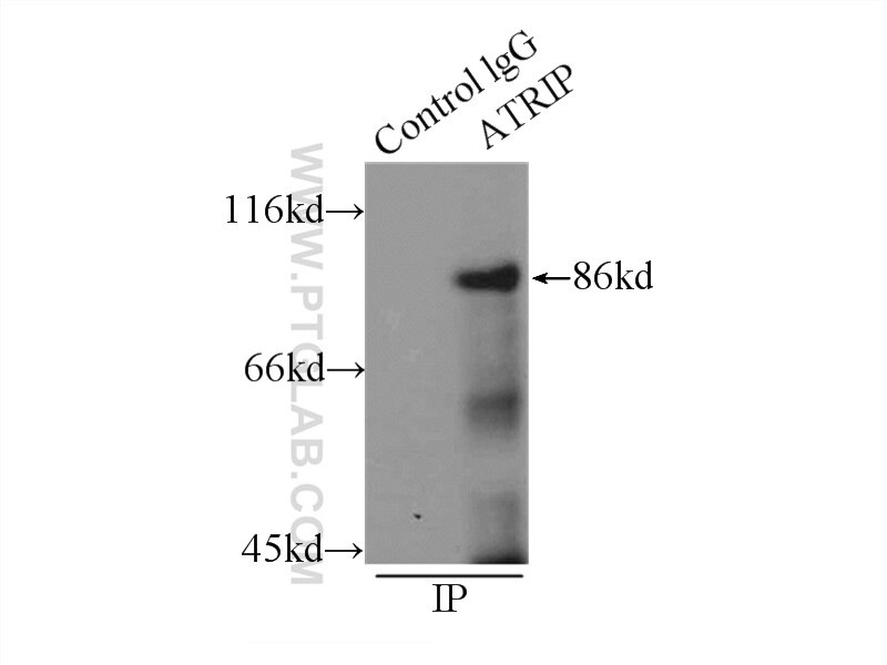 Immunoprecipitation (IP) experiment of MCF-7 cells using ATRIP Polyclonal antibody (11327-1-AP)