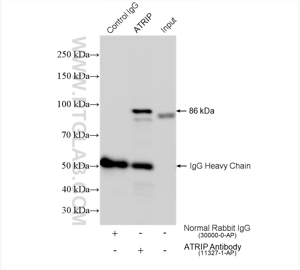 Immunoprecipitation (IP) experiment of HeLa cells using ATRIP Polyclonal antibody (11327-1-AP)