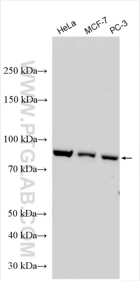 Western Blot (WB) analysis of various lysates using ATRIP Polyclonal antibody (11327-1-AP)