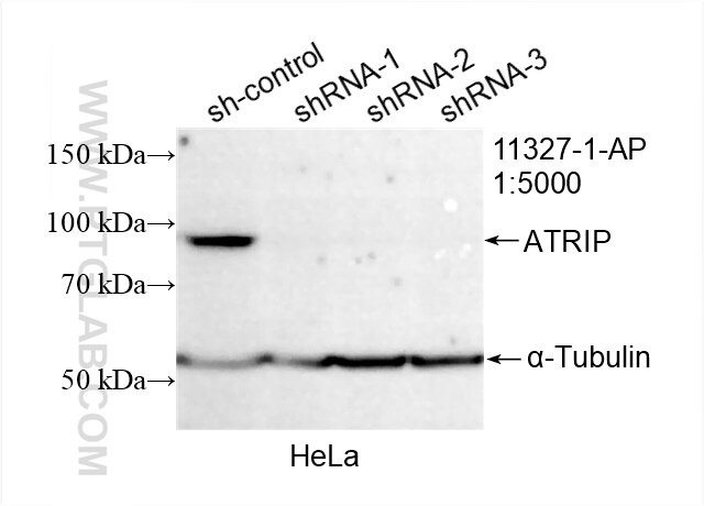 Western Blot (WB) analysis of HeLa cells using ATRIP Polyclonal antibody (11327-1-AP)