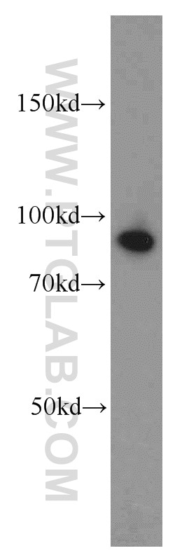 Western Blot (WB) analysis of HeLa cells using ATRIP Polyclonal antibody (11327-1-AP)