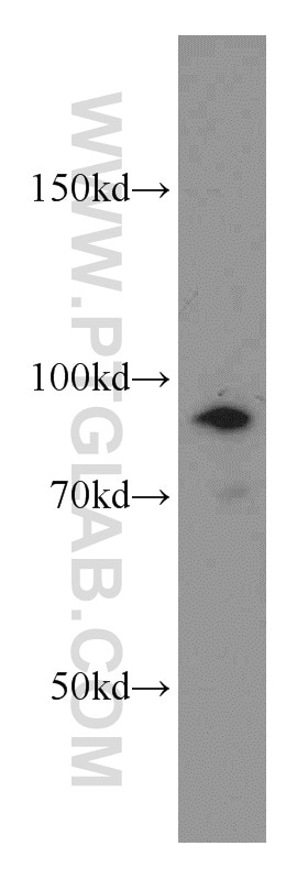 Western Blot (WB) analysis of A549 cells using ATRIP Polyclonal antibody (11327-1-AP)