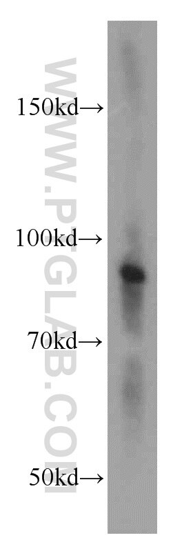 Western Blot (WB) analysis of PC-3 cells using ATRIP Polyclonal antibody (11327-1-AP)