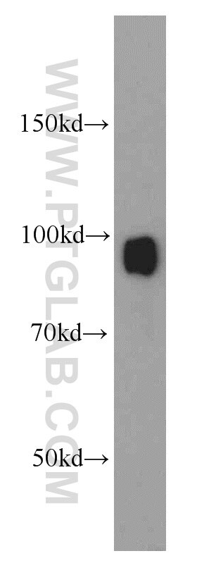 Western Blot (WB) analysis of NIH/3T3 cells using ATRIP Polyclonal antibody (11327-1-AP)