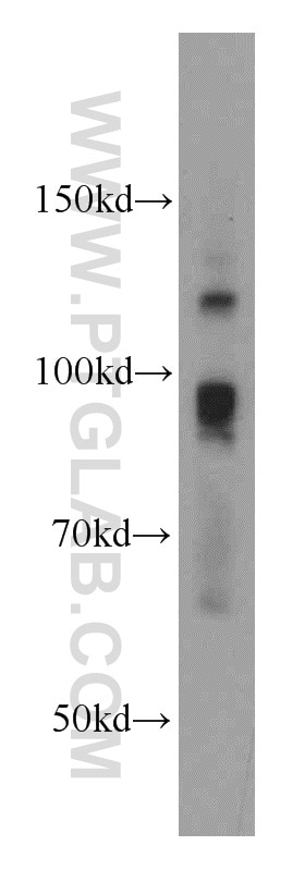 Western Blot (WB) analysis of BxPC-3 cells using ATRIP Polyclonal antibody (11327-1-AP)