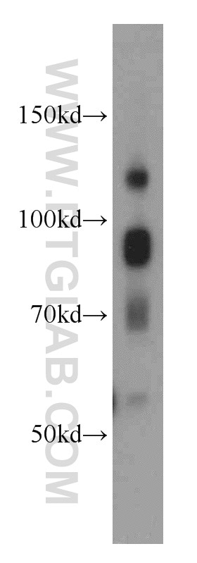 Western Blot (WB) analysis of RAW264.7 using ATRIP Polyclonal antibody (11327-1-AP)