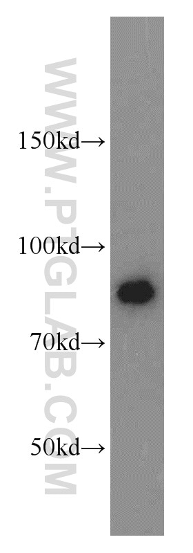 Western Blot (WB) analysis of MCF-7 cells using ATRIP Polyclonal antibody (11327-1-AP)