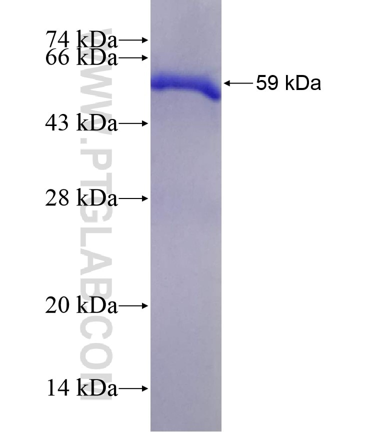 ATRIP fusion protein Ag1869 SDS-PAGE