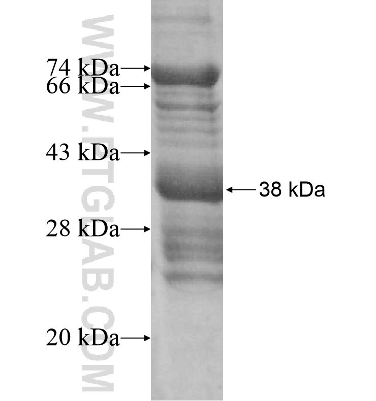 ATRNL1 fusion protein Ag16270 SDS-PAGE
