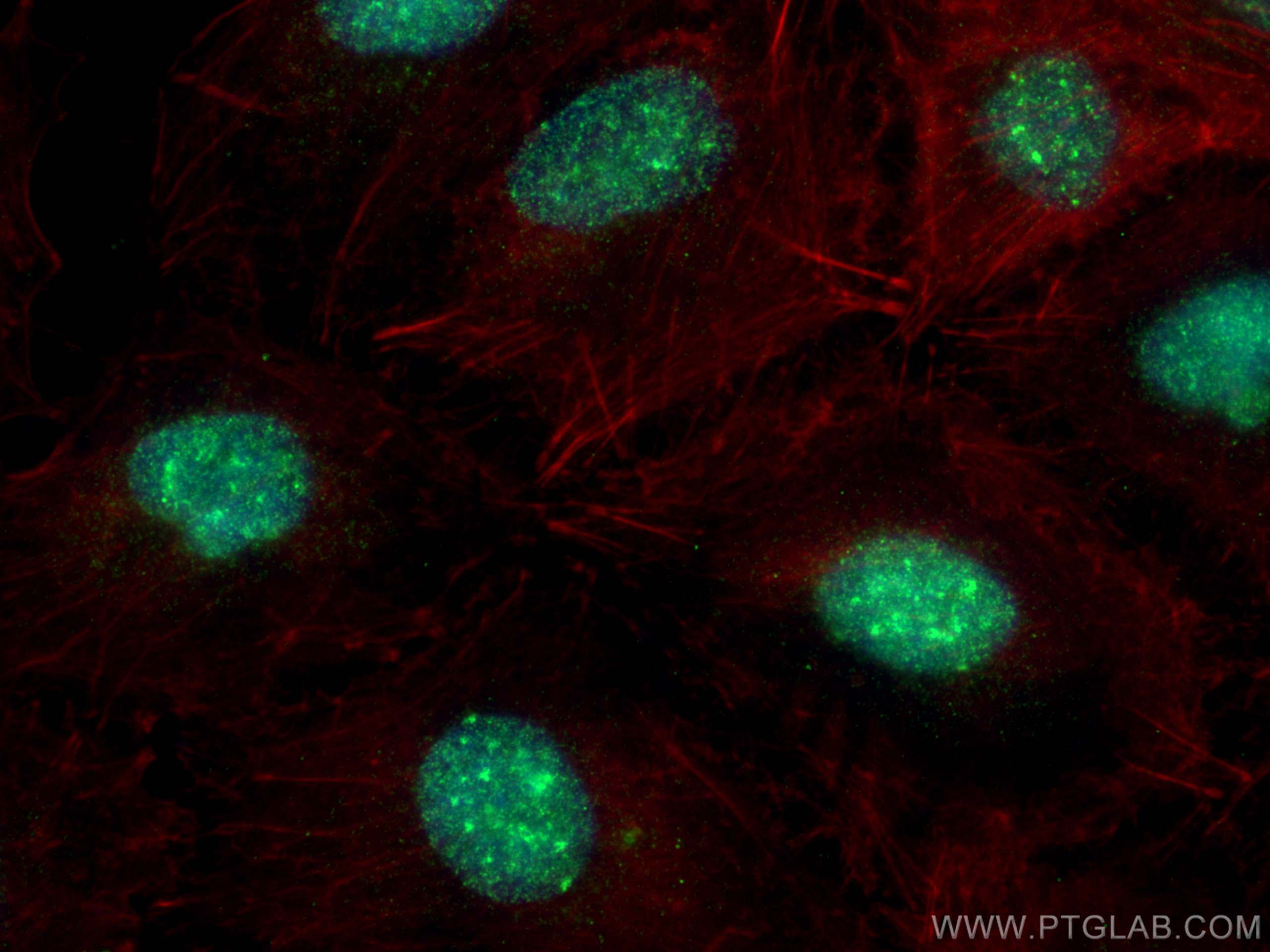 Immunofluorescence (IF) / fluorescent staining of A549 cells using ATRX Polyclonal antibody (20495-1-AP)