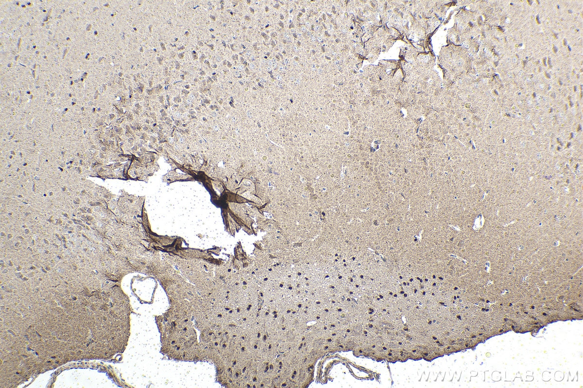 Immunohistochemistry (IHC) staining of rat brain tissue using human ATRX Polyclonal antibody (20495-1-AP)