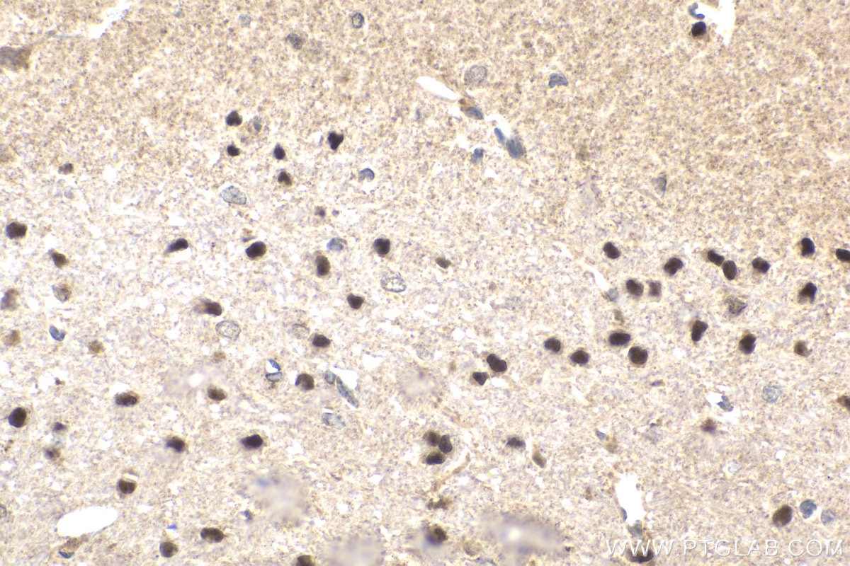 Immunohistochemistry (IHC) staining of rat brain tissue using human ATRX Polyclonal antibody (20495-1-AP)