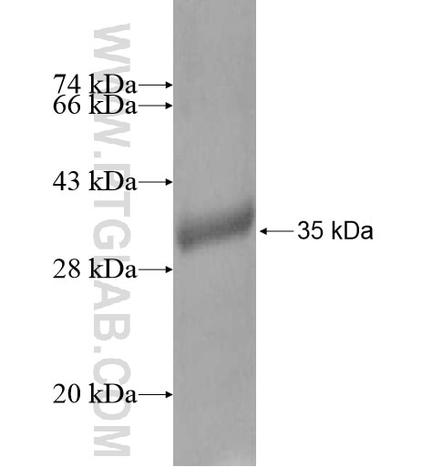 ATRX fusion protein Ag13753 SDS-PAGE