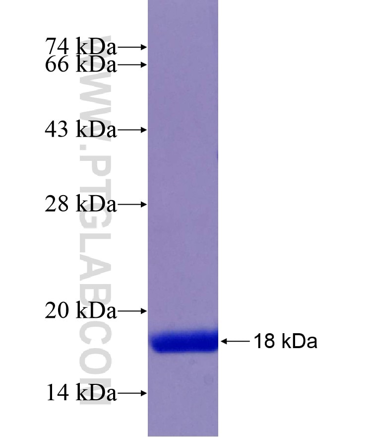 ATRX fusion protein Ag13984 SDS-PAGE