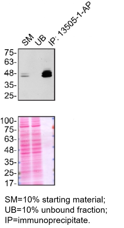 Immunoprecipitation (IP) experiment of HEK-293 cells using ATX3,ATXN3 Polyclonal antibody (13505-1-AP)