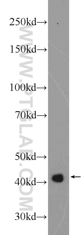 Western Blot (WB) analysis of HEK-293 cells using ATX3,ATXN3 Polyclonal antibody (13505-1-AP)