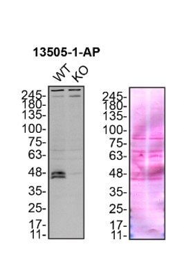 Western Blot (WB) analysis of HEK-293 cells using ATX3,ATXN3 Polyclonal antibody (13505-1-AP)
