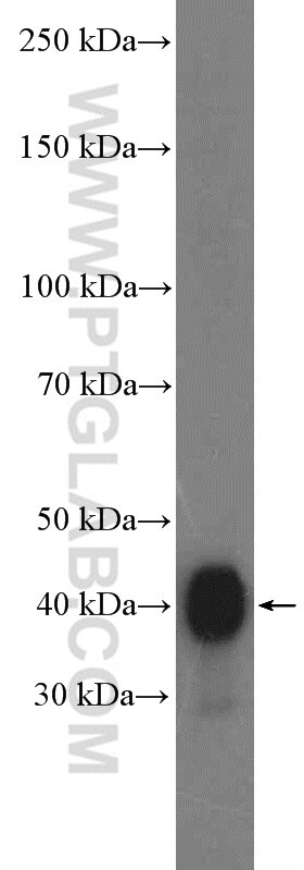Western Blot (WB) analysis of mouse brain tissue using ATX3,ATXN3 Polyclonal antibody (13505-1-AP)