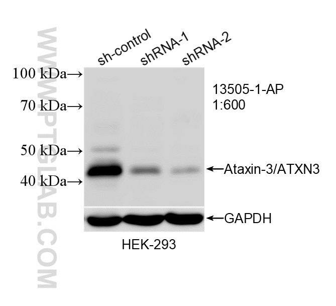 Western Blot (WB) analysis of HEK-293 cells using Ataxin-3/ATXN3 Polyclonal antibody (13505-1-AP)