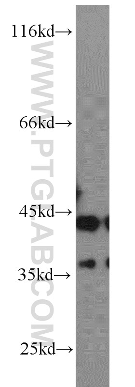 Western Blot (WB) analysis of mouse liver tissue using ATX3,ATXN3 Polyclonal antibody (13505-1-AP)