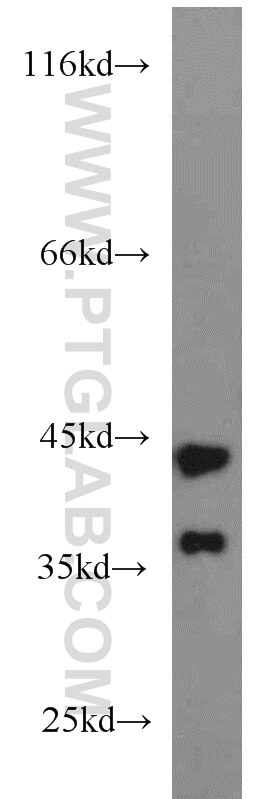 Western Blot (WB) analysis of mouse liver tissue using ATX3,ATXN3 Polyclonal antibody (13505-1-AP)