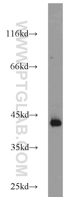 Western Blot (WB) analysis of mouse heart tissue using ATX3,ATXN3 Polyclonal antibody (13505-1-AP)