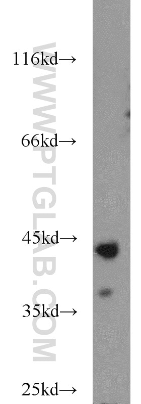 Western Blot (WB) analysis of mouse placenta tissue using ATX3,ATXN3 Polyclonal antibody (13505-1-AP)
