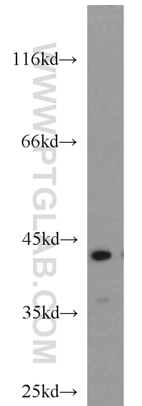 Western Blot (WB) analysis of mouse placenta tissue using ATX3,ATXN3 Polyclonal antibody (13505-1-AP)