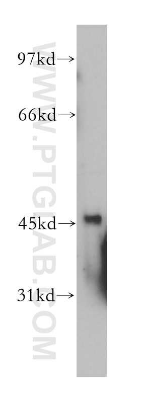 ATX3,ATXN3 Polyclonal antibody