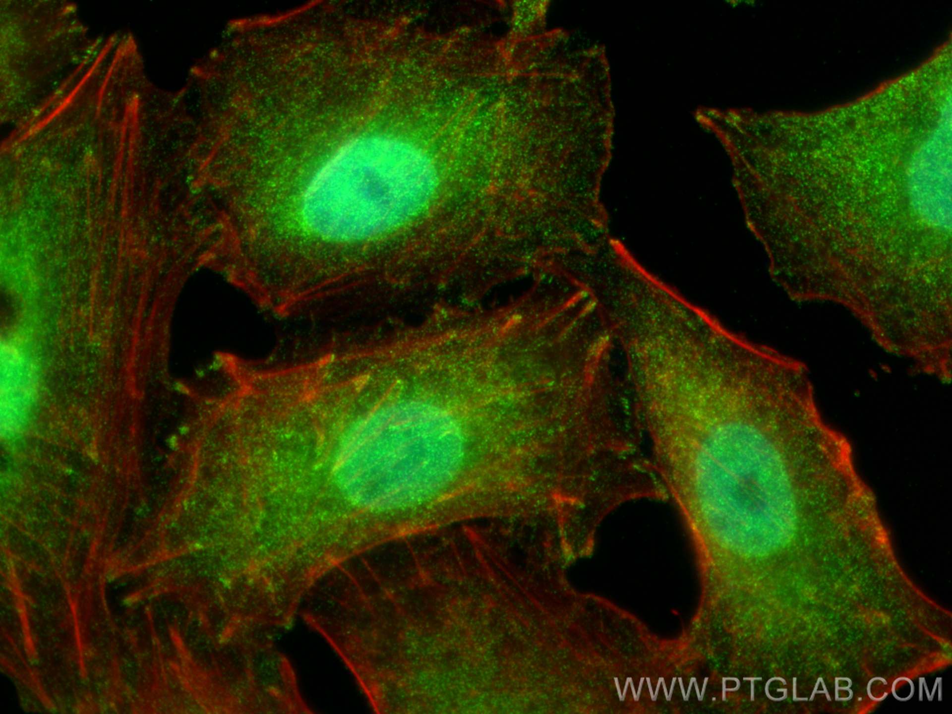 Immunofluorescence (IF) / fluorescent staining of A549 cells using ATX3,ATXN3 Monoclonal antibody (67057-1-Ig)
